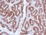 BNUB0897-MUCA5-CLH2-IHC