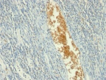 Adenosine Monophosphate Deaminase 3 (AMPD3)(AMPD3/901), 0.2mg/mL