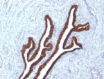 BNUB0906-0-1
