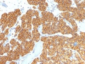 PTH / Parathyroid Hormone (N-Terminal)(PTH/911), CF740 conjugate, 0.1mg/mL