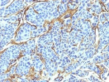 NGFR (Nerve Growth Factor Receptor)(NTR/912), CF488A conjugate, 0.1mg/mL