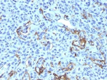 NGFR (Nerve Growth Factor Receptor)(NGFR5 + NTR/912), CF488A conjugate, 0.1mg/mL