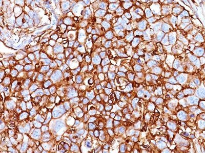 BNUB0918-0-1 BNUB0918 0 1- Immunomart