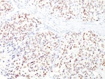 MiTF (Microphthalmia Transcription Factor)(D5 + MITF/915), CF488A conjugate, 0.1mg/mL