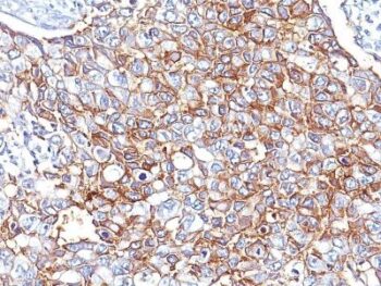 Ep-CAM / CD326(Cocktail PAN-EpCAM), 0.2mg/mL