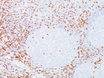 CD7(T3-3A1), 1mg/mL