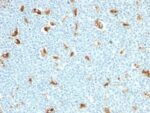 S100A9(S100A9/1011), 0.2mg/mL 1 BNUB1011-0-1