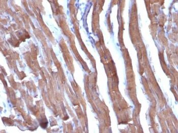 Actin, Muscle Specific (Muscle Cell Marker)(HHF35 + MSA/953), 1mg/mL