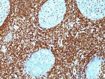 bcl-2(BCL2/782 + BCL2/796), 0.2mg/mL