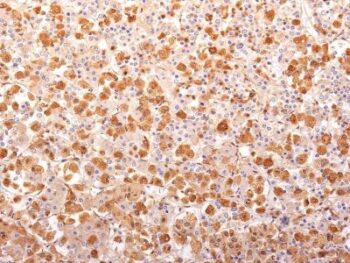 ACTH (Adrenocorticotrophic Hormone)(AH26 + 57), 0.2mg/mL