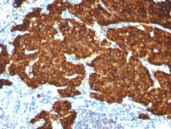 Chromogranin A(CGA414 + CGA/777 + CGA/798), 0.2mg/mL