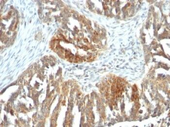 VEGF-A(VEGF/1063), 0.2mg/mL