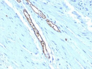 Blood Group Antigen A(HE-193), 0.2mg/mL