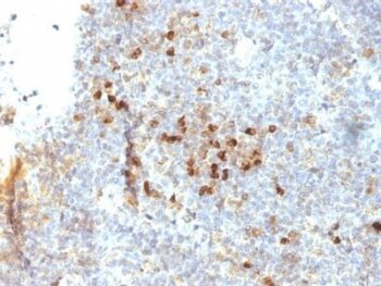 MHC II (HLA-DRA)(19-26.1), 0.2mg/mL