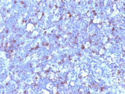 BNUB1094-0-1 BNUB1094 0 1- Immunomart