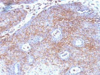 Beta-2-Microglobulin (B2M)(B2M/1118), CF594 conjugate, 0.1mg/mL