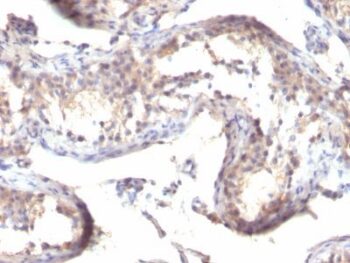 TGFalpha(TGFA/1119), CF640R conjugate, 0.1mg/mL