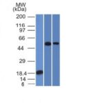 BNUB1124-0-1