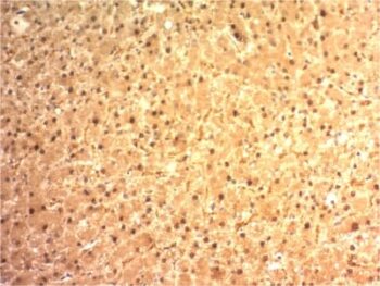 Arginase 1 (Hepatocellular Carcinoma Marker) (ARG1/1125) , 0.2mg/mL