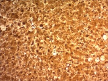 Arginase 1 (Hepatocellular Carcinoma Marker) (ARG1/1126) , CF568 conjugate, 0.1mg/mL