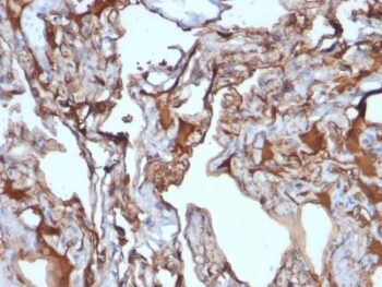 MUC18 / Mucin 18 / CD146(MUC18/1130), Biotin conjugate, 0.1mg/mL