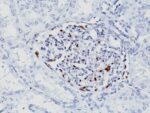 WT1 (Wilm's Tumor 1)(WT1/857 + 6F-H2), CF568 conjugate, 0.1mg/mL