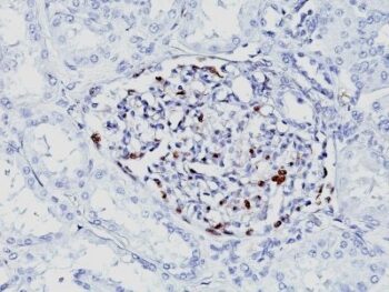 WT1 (Wilm's Tumor 1)(WT1/857 + 6F-H2), CF568 conjugate, 0.1mg/mL