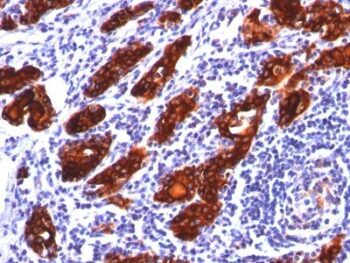 CD71(TFRC/1149), 0.2mg/mL