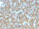 PTH / Parathyroid Hormone (N-Terminal)(PTH/1174), CF740 conjugate, 0.1mg/mL
