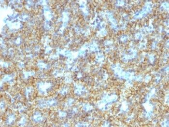 PTH / Parathyroid Hormone (N-Terminal)(PTH/1174), CF740 conjugate, 0.1mg/mL