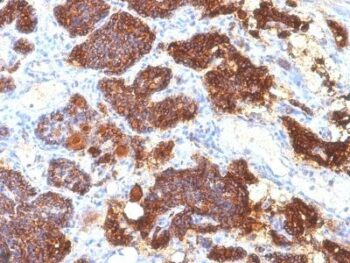 PTH / Parathyroid Hormone (N-Terminal)(PTH/1175), CF568 conjugate, 0.1mg/mL