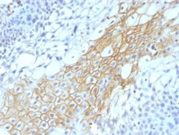 CD59 (heavy chain of Protectin)(MACIF/1193), 0.2mg/mL