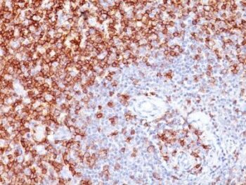 CD45RO(UCHL1 + T200/797), 0.2mg/mL