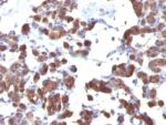 Thyroglobulin(TGB04 + TGB05), 1mg/mL 1 BNUB1227-0-1