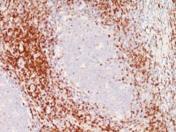 CD6(C6/372 + 3F7B5), 0.2mg/mL