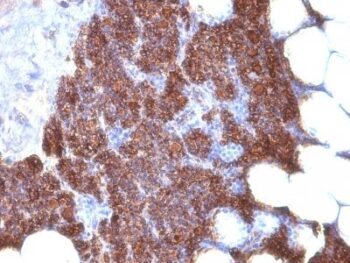 PTH (Parathyroid Hormone) (N & C Terminal) (3H9 + PTH/1175), CF740 conjugate, 0.1mg/mL