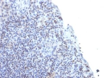 ETS1 / (Marker of Tumor Metastasis) (ETS1/1282), CF568 conjugate, 0.1mg/mL