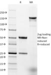 Ep-CAM / CD326 (Extracellular Domain) (Epithelial Marker) (EGP40/1384), CF594 conjugate, 0.1mg/mL