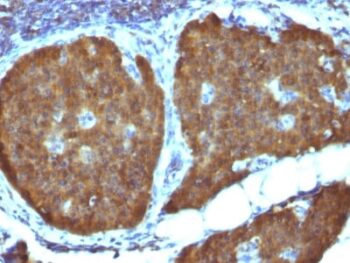 NSE gamma (Neuron Specific Enolase, gamma) (Neuroendocrine Marker) (ENO2/1462), CF568 conjugate, 0.1mg/mL