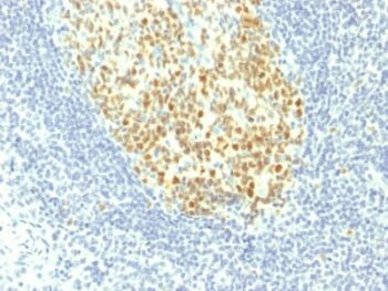 MCM7 (Proliferation Marker) (MCM7/1467), 0.2mg/mL