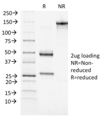 BRCA1 (Breast Marker) (BRCA1/1472), 0.2mg/mL