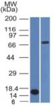 Bcl-6 (Follicular Lymphoma Marker) (BCL6/1475), CF568 conjugate, 0.1mg/mL