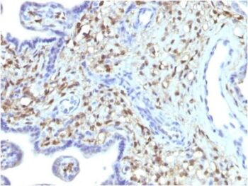 S100A4 (Marker of Tumor Metastasis) (S100A4/1481), CF740 conjugate, 0.1mg/mL