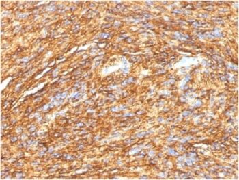 DOG-1 / TMEM16A (Gastrointestinal Stromal Tumor Marker) (DG1/1484), CF647 conjugate, 0.1mg/mL
