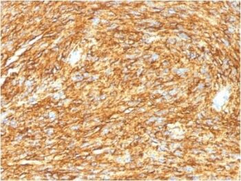 DOG-1 / TMEM16A (Gastrointestinal Stromal Tumor Marker) (DG1/1485), CF647 conjugate, 0.1mg/mL