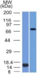 MMP2 / Collagenase Type IV A (Tumor Metastasis Marker) (MMP2/1501), 1mg/mL