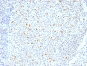 Bcl-6 (Follicular Lymphoma Marker) (BCL6/1526), CF488A conjugate, 0.1mg/mL