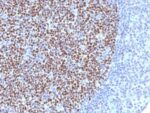 Bcl-6 (Follicular Lymphoma Marker) (BCL6/1527), CF640R conjugate, 0.1mg/mL 1 BNUB1527