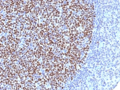 BNUB1527 BNUB1527- Immunomart