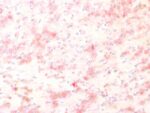 Tyrosinase-Related Protein-1 (TYRP-1) (Melanoma Marker) (TYRP1/1564R), 1mg/mL 1 BNUB1564-0